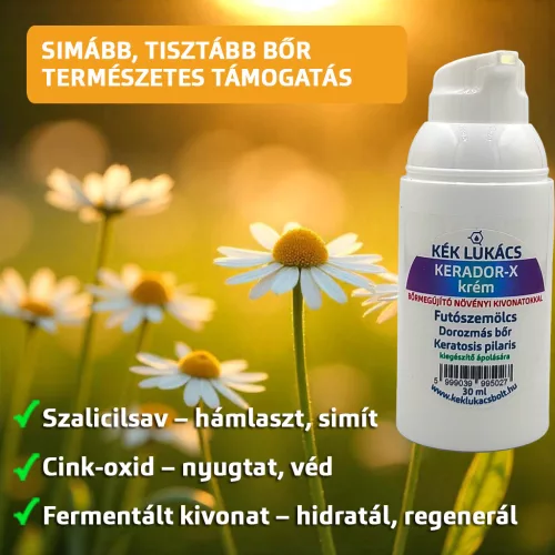 Kék Lukács Kerador-X krém (futó szemölcs, talpiszemölcs, dorozmás bőr, keratosis pilaris)