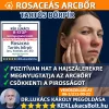 Kék Lukács R-Stop Bőrnyugtató krém - Rosacea, tartós bőrpír megújult csomagolásban Rozacetin