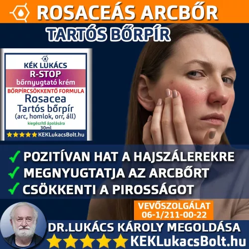 Kék Lukács R-Stop Bőrnyugtató krém - Rosacea, tartós bőrpír megújult csomagolásban Rozacetin