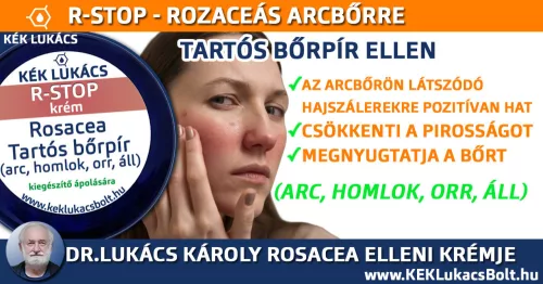 Kék Lukács R-Stop Bőrnyugtató krém - Rosacea, tartós bőrpír megújult csomagolásban Rozacetin
