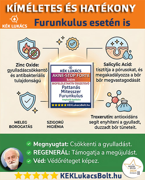 Lehet-e krémmel kezelni a furunkulust? Igen a KÉK Lukács Akne-STOP forte krémet ajánljuk.