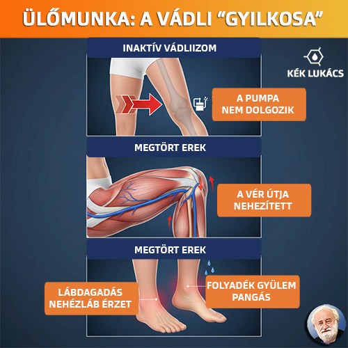 Az ülőmunka: A vádli gyilkosa | KÉK Lukács blog