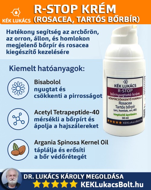 Hogyan segíthet a Kék Lukács R-STOP krém?