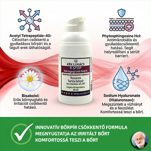 Rosacea elleni leghatékonyabb krém KÉK Lukács R-STOP bőrnyugtató krém