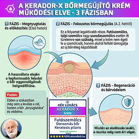 Futó-, talpi- és uszodaszemölcs ellen agresszió nélkül? Így működik a KERADOR-X 3 fázisú módszere