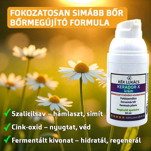 Talpi szemölcsre a megoldás: Kerador-X Bőrmegújító krém 