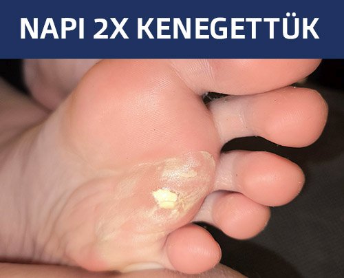 Kerador-X fontos a napi 2x használata