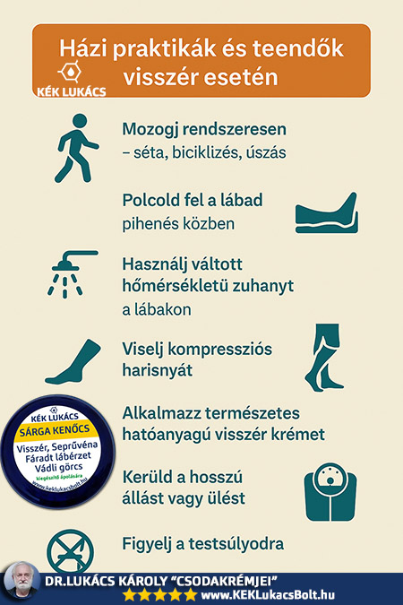 Házi praktikák és teendők visszér esetén